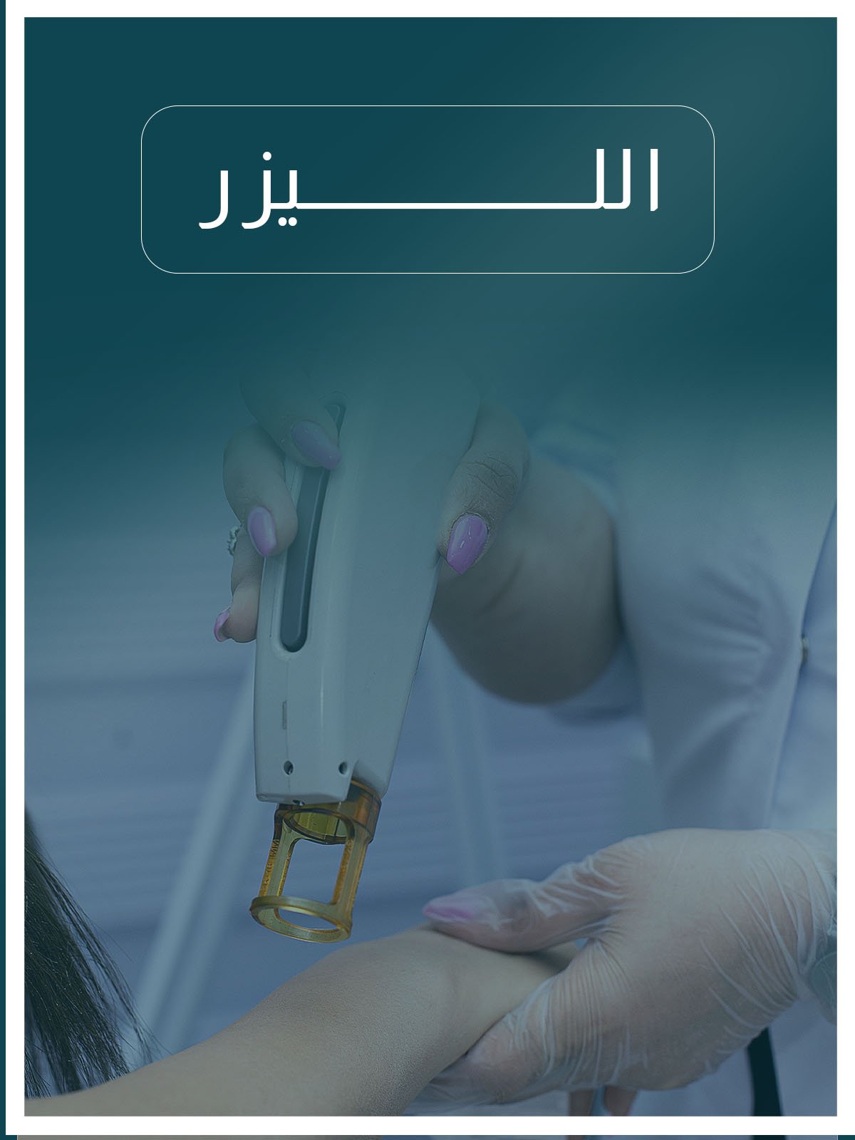 الليزر